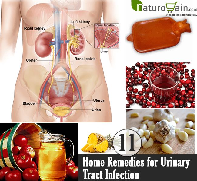 11 Best Home Remedies for Urinary Tract Infection to Improve Bladder Health