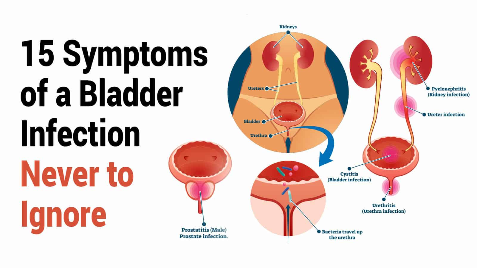 15 of Symptoms of a Bladder Infection Never to Ignore