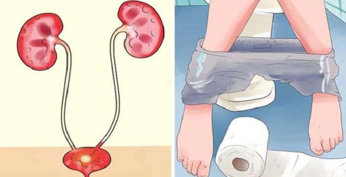8 Effective home remedies for Urinary Tract Infections (UTI)! Must Learn!