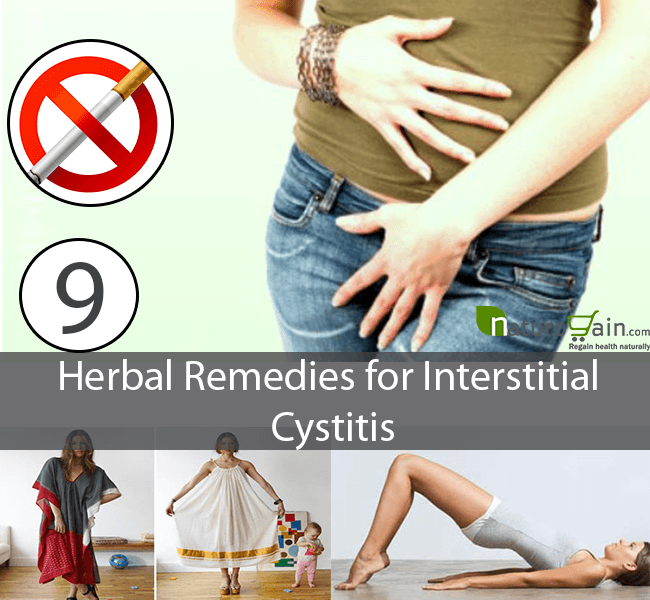 9 Powerful Herbal Remedies for Interstitial Cystitis