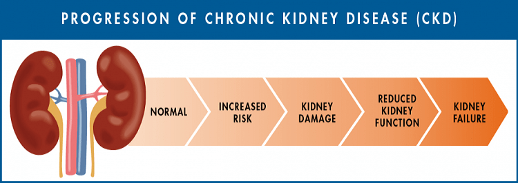 A Complete 6 Step Guide to Protect Your Kidneys for Better Kidney Health