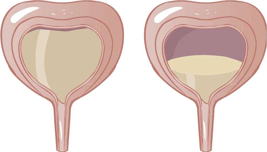 Botox Approved for Overactive Bladder Treatment