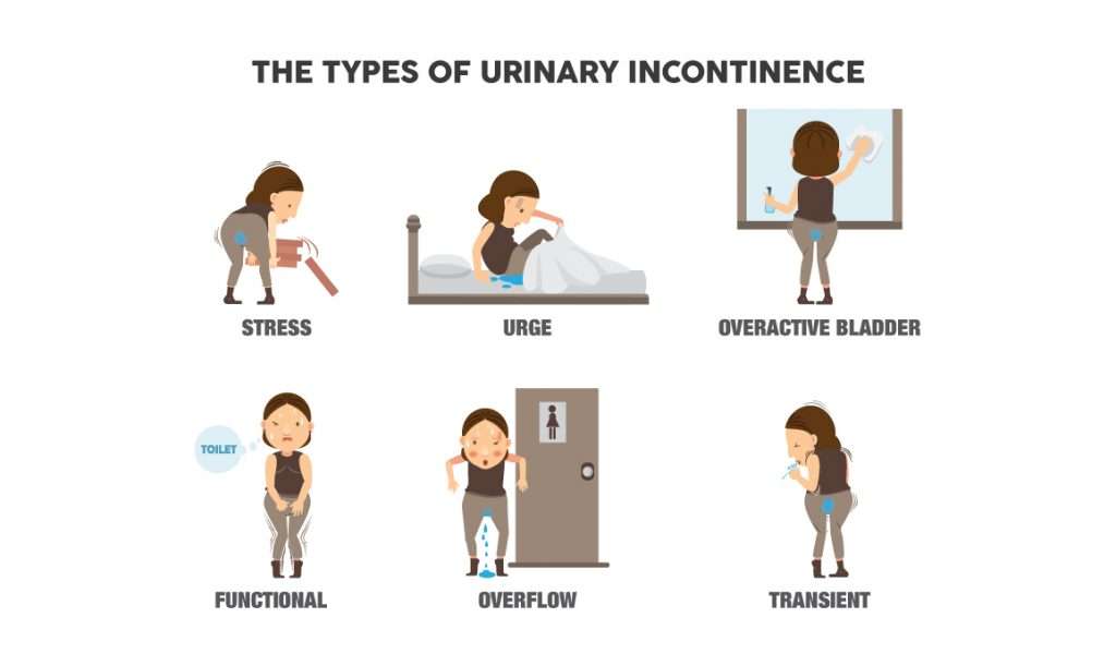 Causes of Incontinence