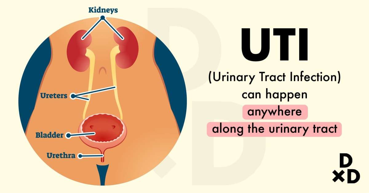 Does It Hurt When You Pee? You May Have a Urinary Tract Infection ...