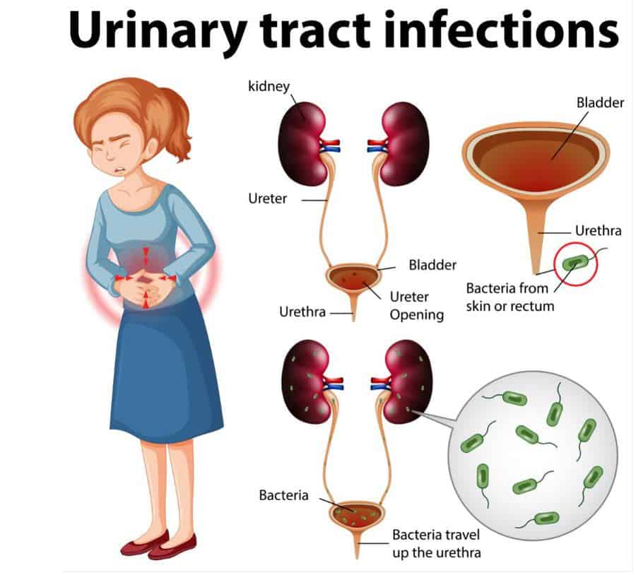 Does Uti Cause Blood In Urine