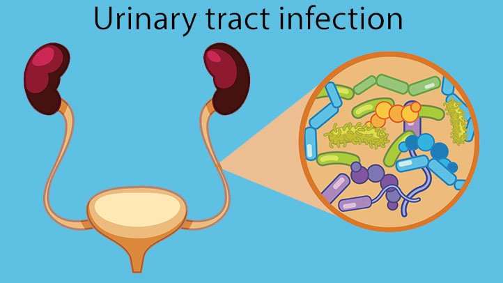 E. coli and Urinary Tract Infections (UTIs)