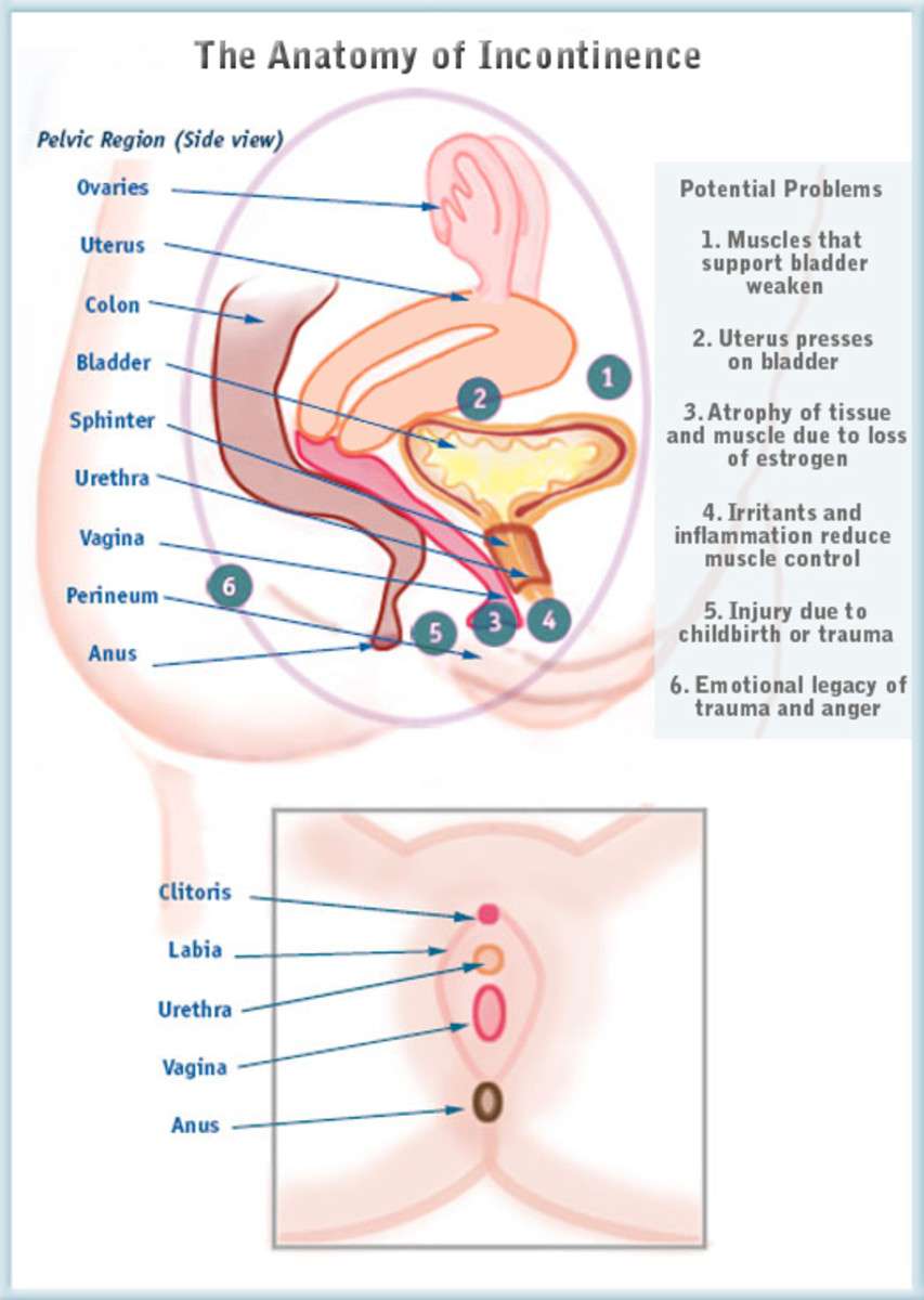 Female Urinary Incontinence in Women