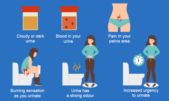 Female UTIs â Your Burning Questions Answered