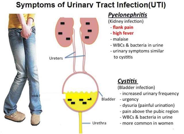 Fighting Urinary Tract Infection (UTI)