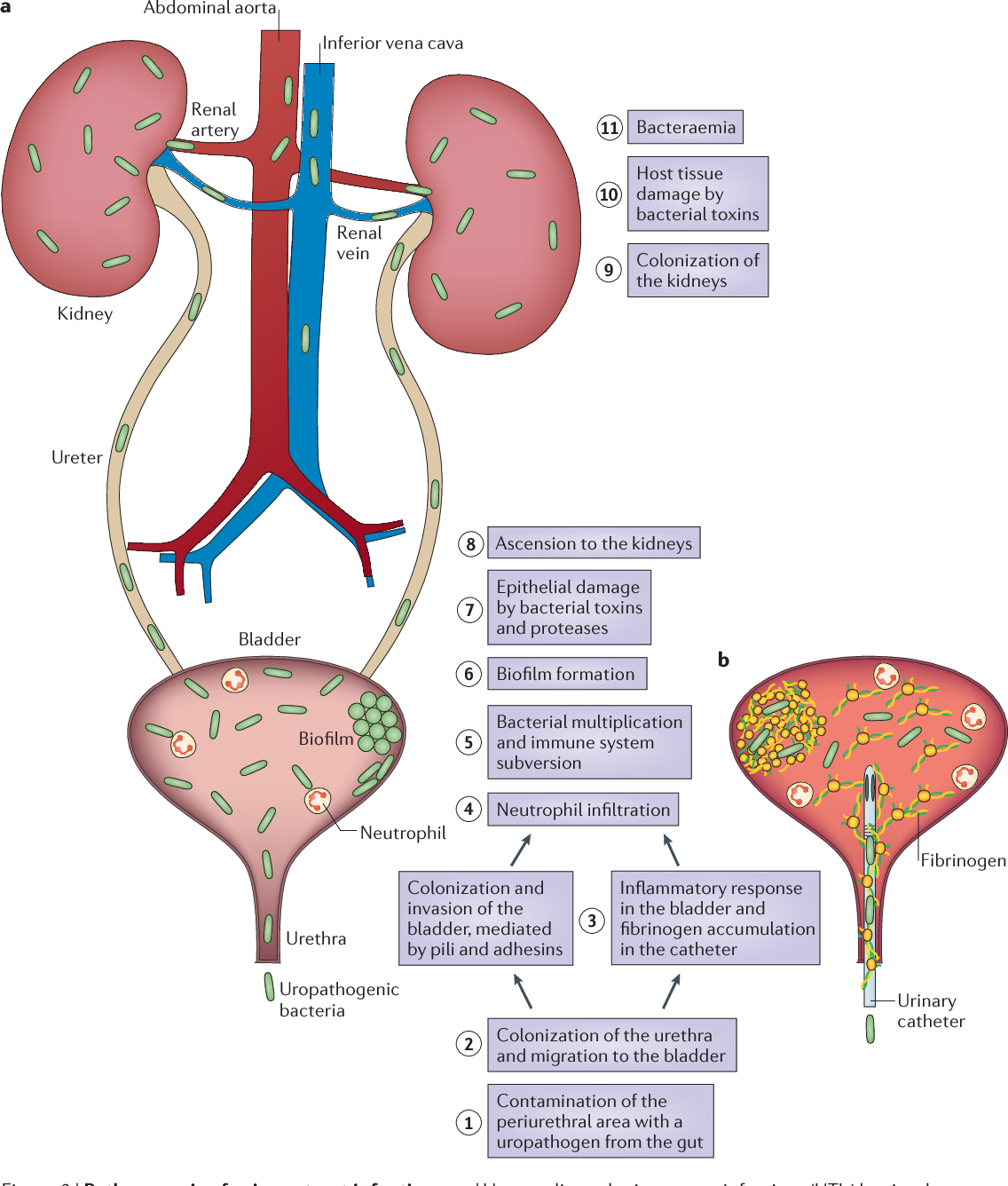 Figure 2 from Urinary tract infections: epidemiology, mechanisms of ...