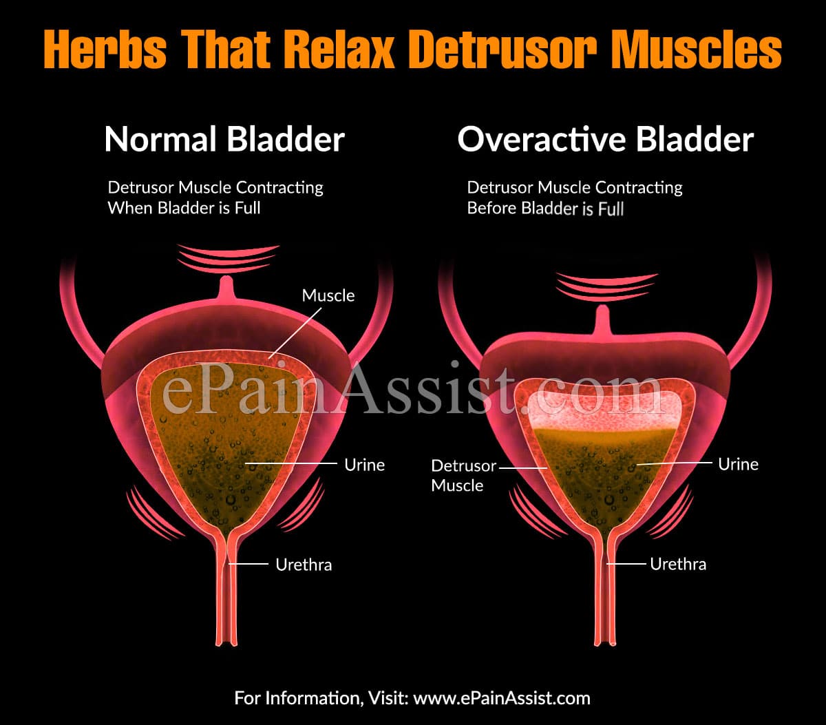 Herbs That Relax Detrusor Muscles