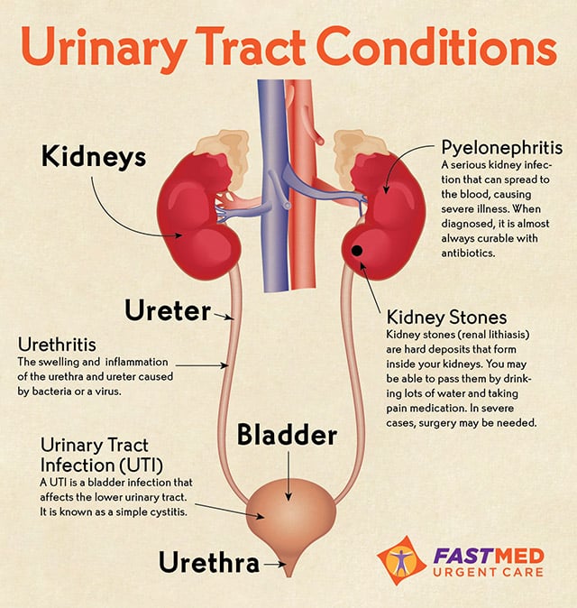 Home treatment for urethritis: Urethritis in Men Symptoms, Causes ...
