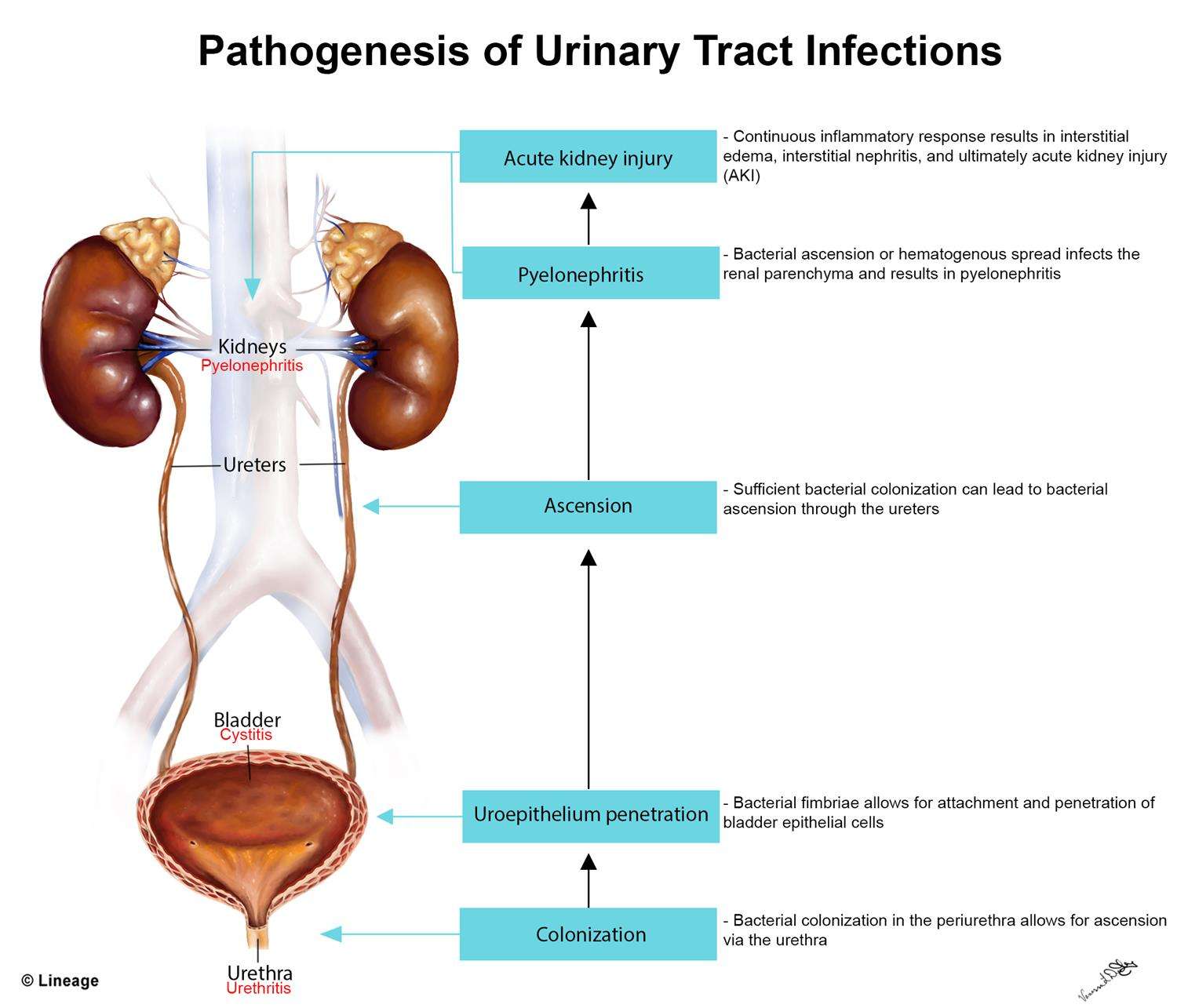 How To Know If Urinary Tract Infection