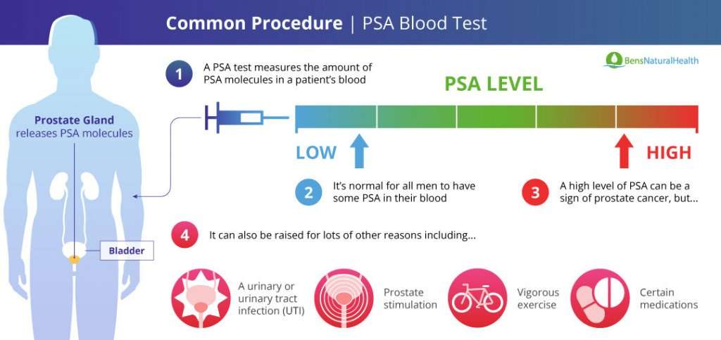 How To Lower Your PSA Level Safely And Effectively