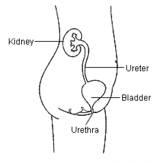 How to Prevent and Cure Urinary Tract Infection (UTI)?