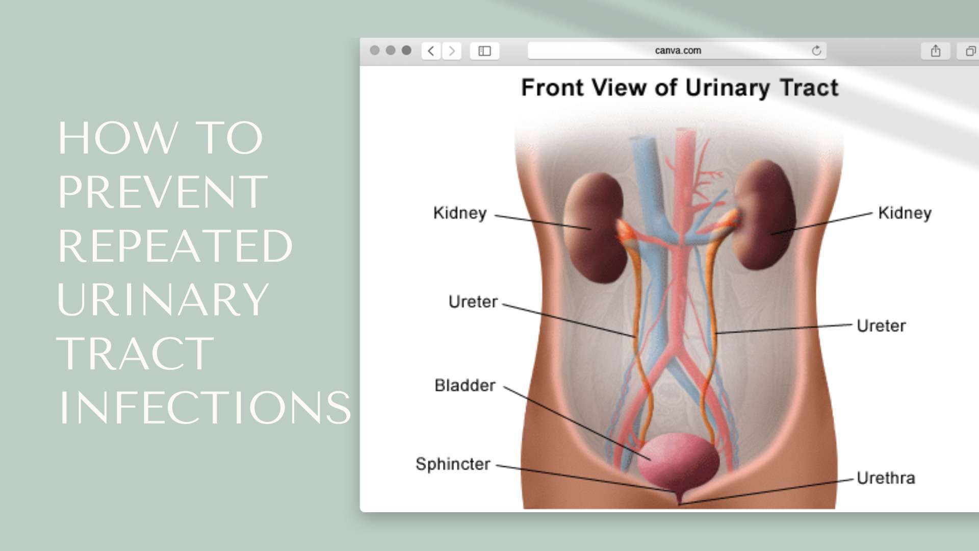 How to prevent urinary tract infections (UTI)?  Balance ...