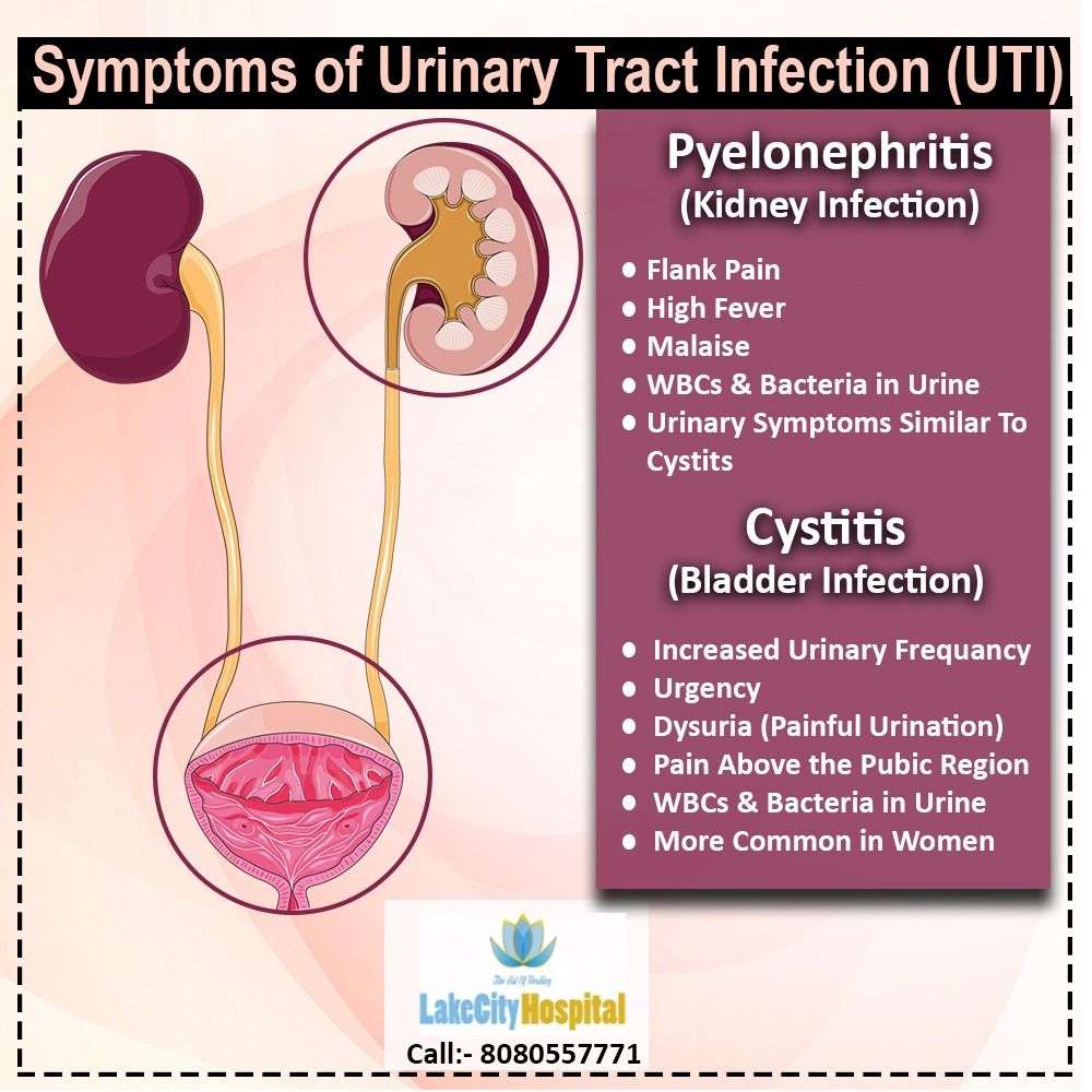 How To Tell If Uti Or Kidney Infection