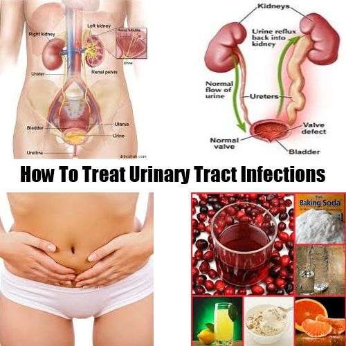How To Treat Urinary Tract Infections #UTI