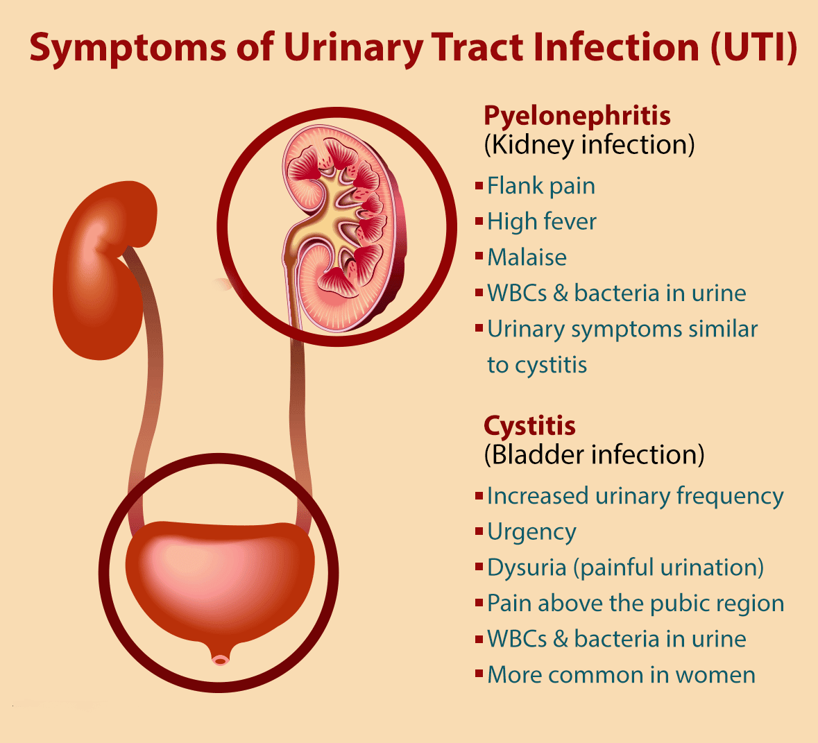 In pregnant women, UTIs pose a special concern because they are not ...