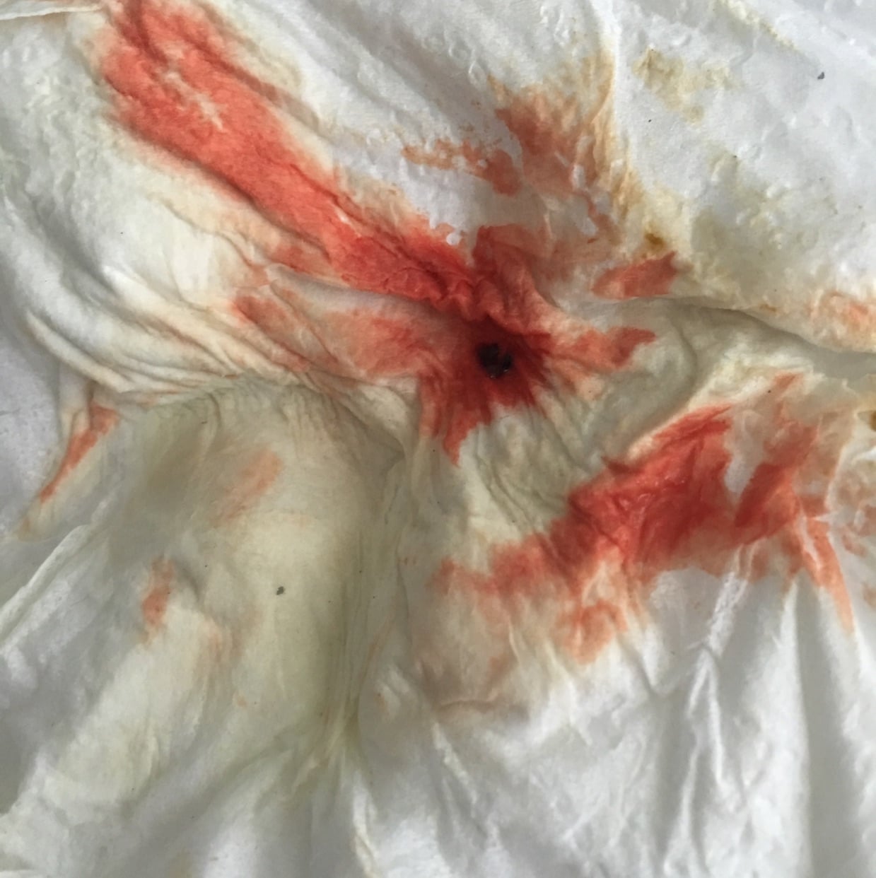 Is It Normal To Bleed With A Uti