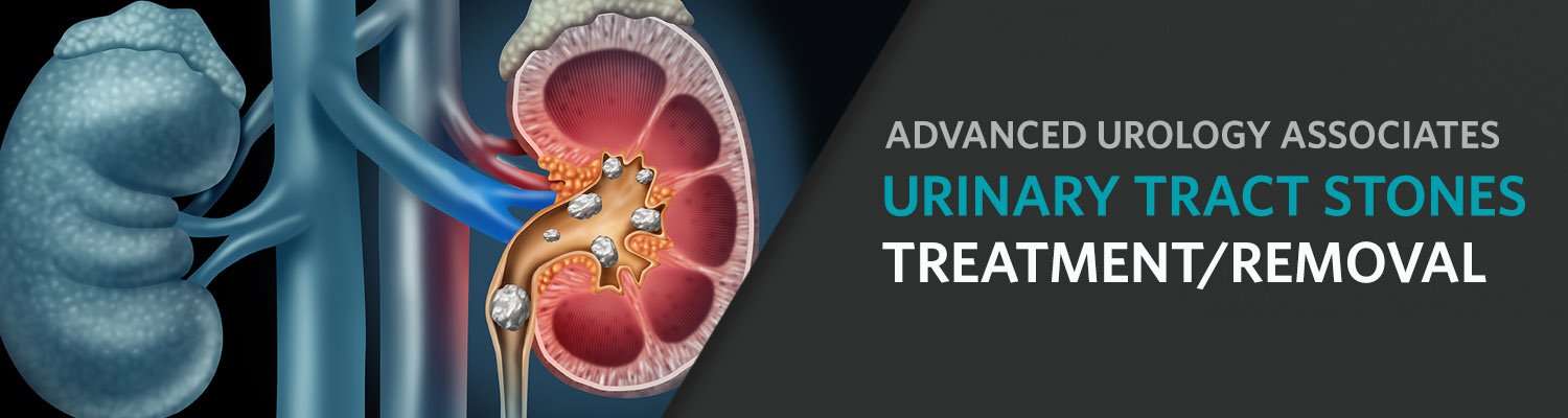 Kidney Stone Screening at Advanced Urology Associates