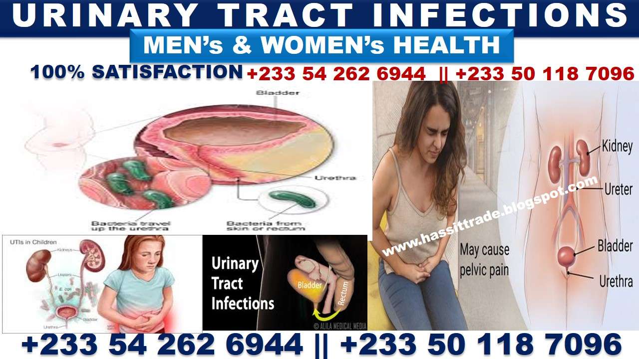 NATURAL REMEDY FOR URINARY TRACT INFECTIONS (UTI ...