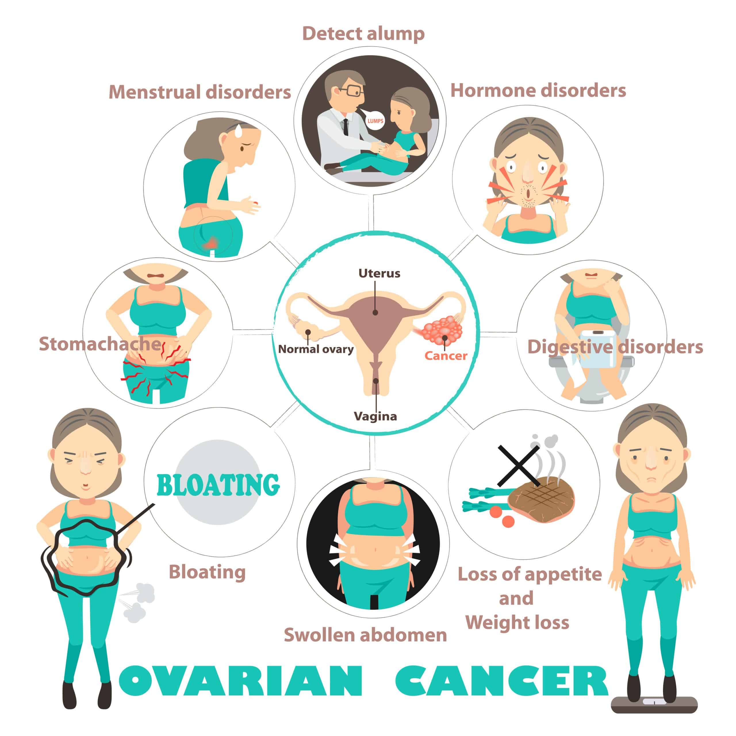 September is Ovarian Cancer Awareness Month