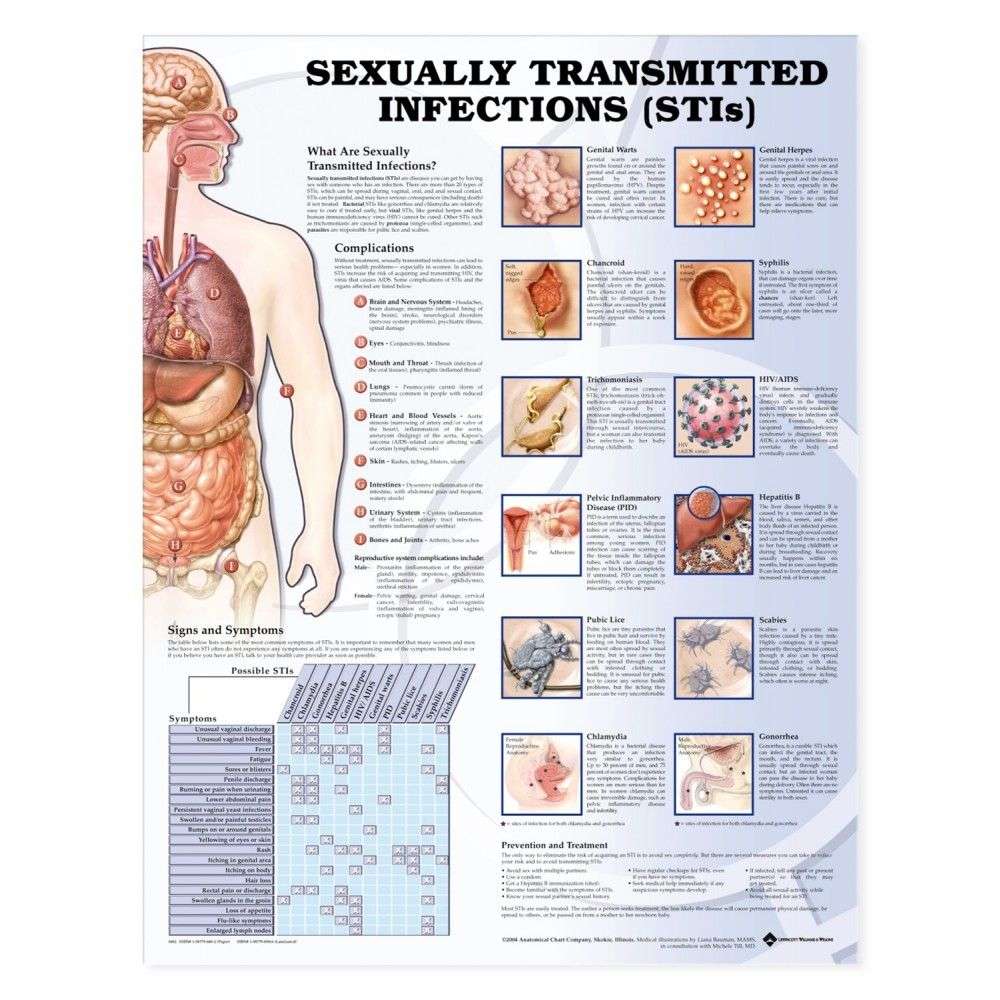 Sexually Transmitted Infections (STIs) Chart / Poster