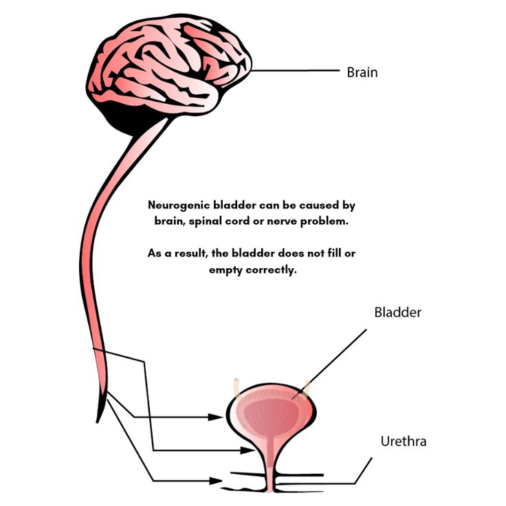 Spinal Cord Injuries and Neurogenic Bladders