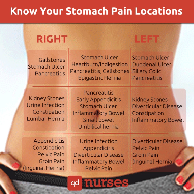 Stomach Pain Locations Chart for the NCLEX