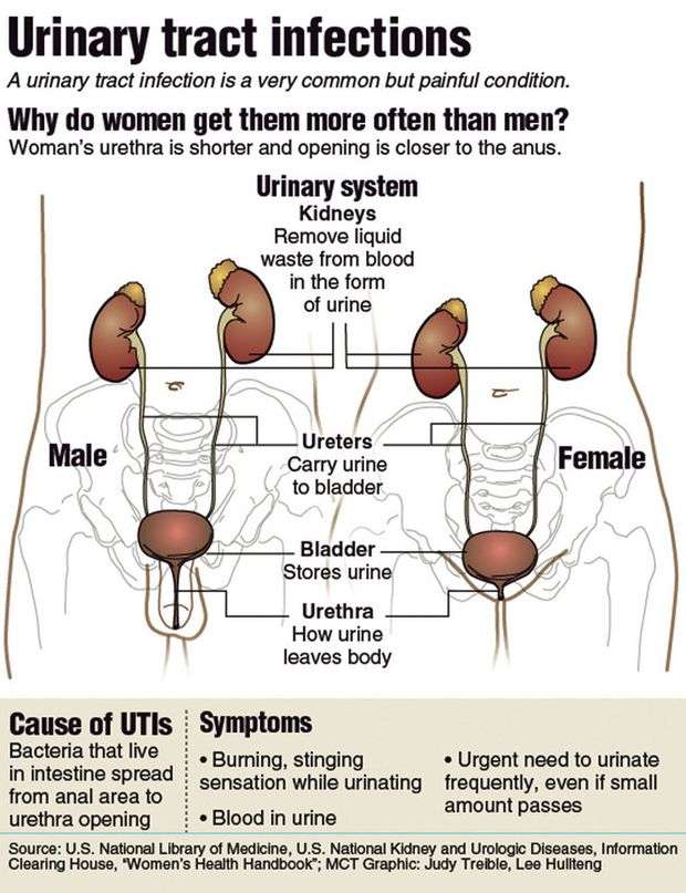 Stop those UTIs: Infection is common among women