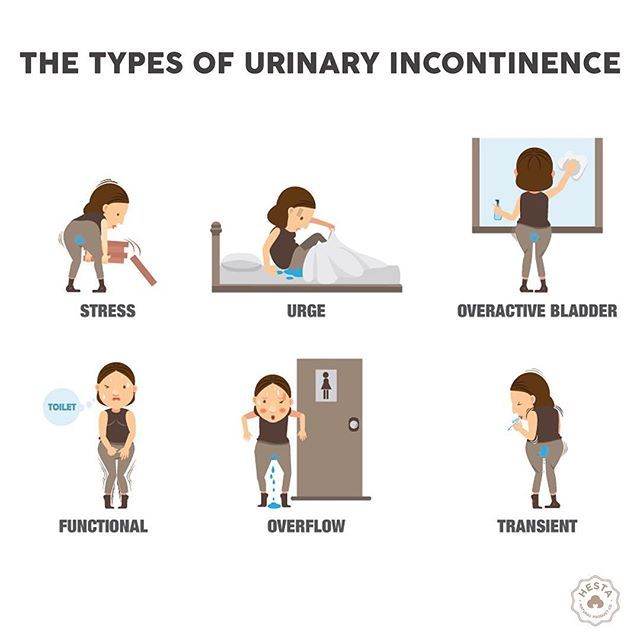STRESS Leakage of small amounts of urine during physical movement ...