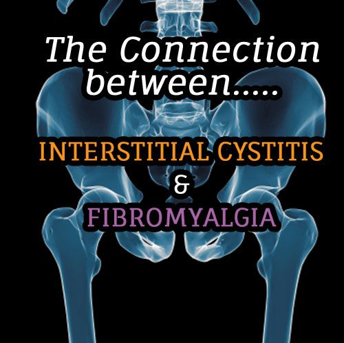 The Connection between Interstitial Cystitis and Fibromyalgia