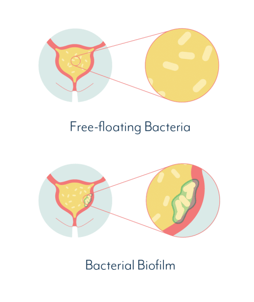 The Role Of Biofilms In Chronic UTIs â Native Formulas