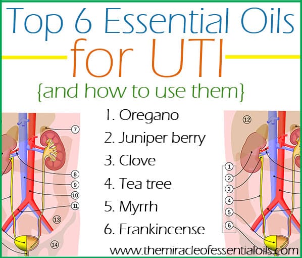 Top 6 Essential Oils for UTI (Urinary Tract Infection)