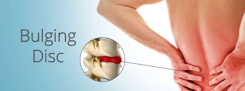 Unlock Hip Flexor Tips: back pain causes urinary problems