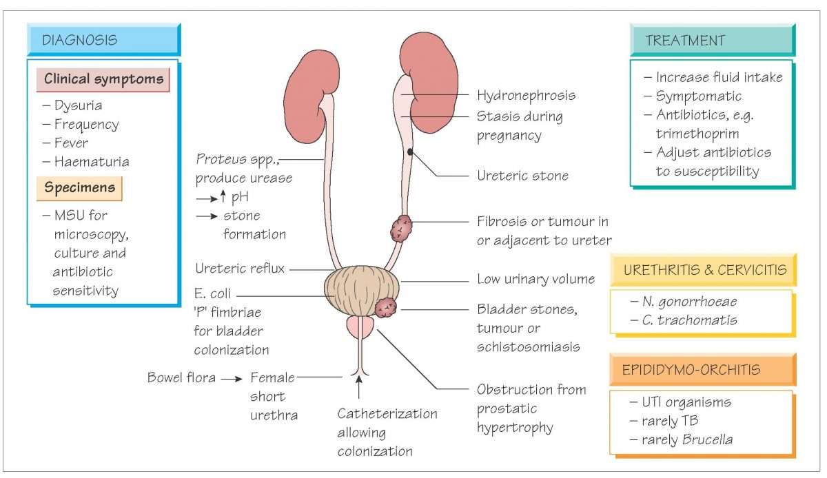 Urinary and genital infections (Systemic infection)