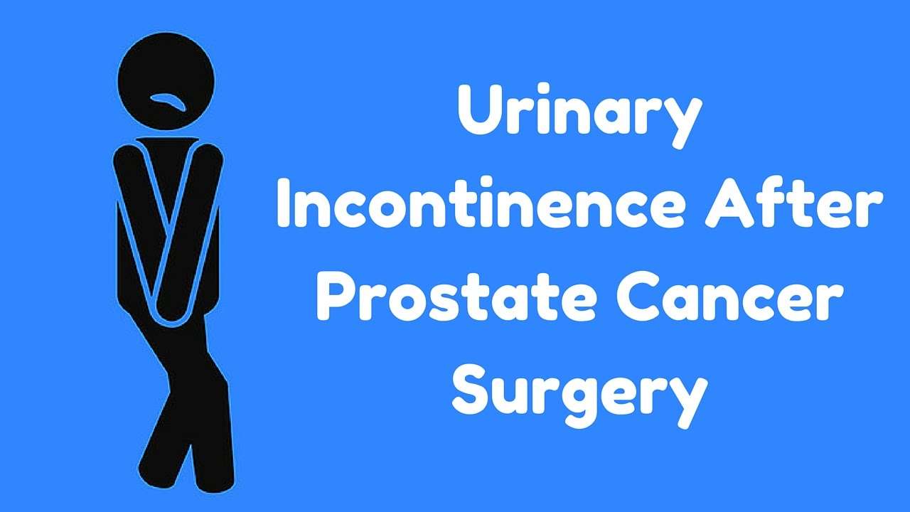 Urinary Incontinence After Prostate Cancer Surgery