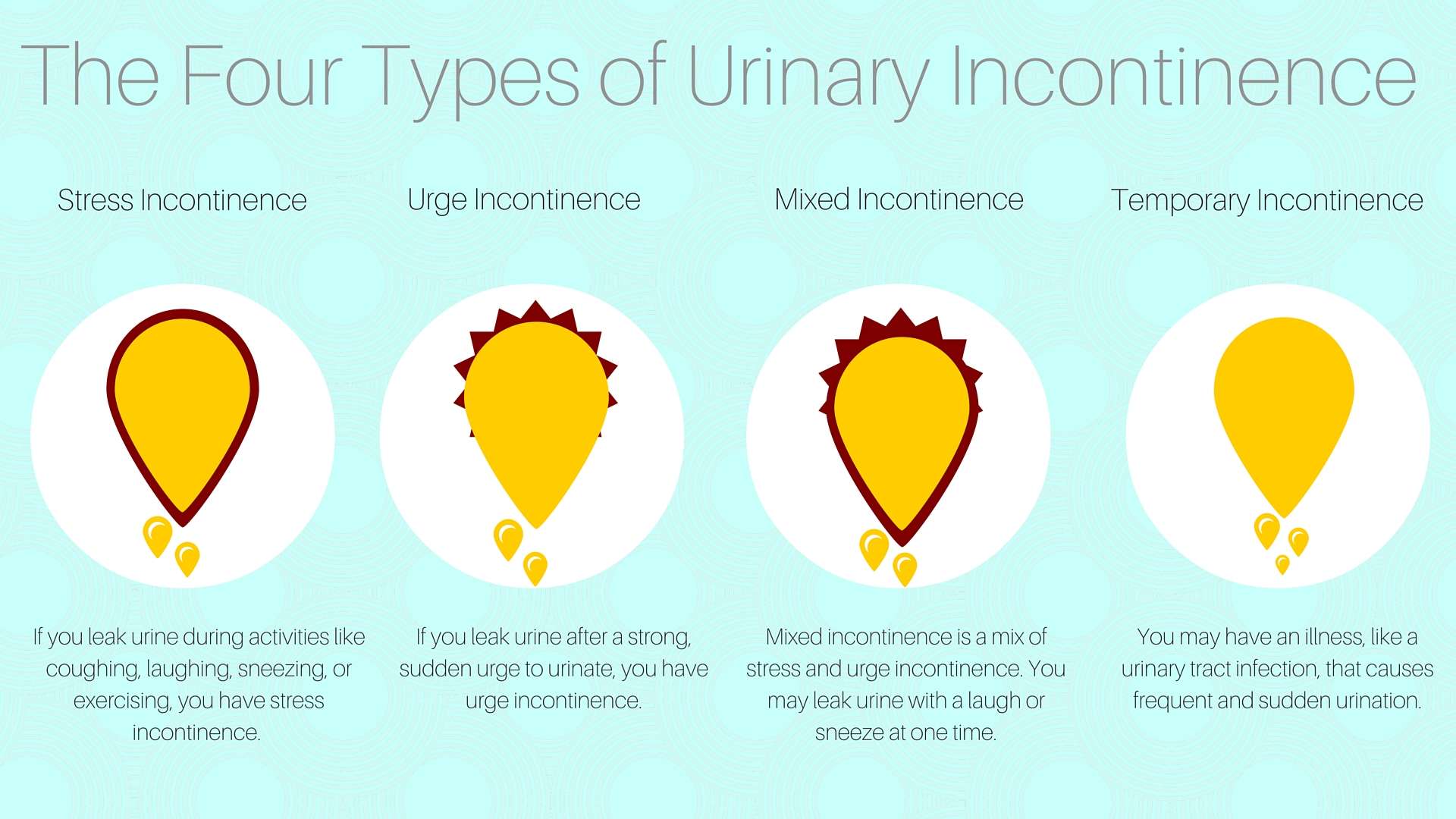 Urinary incontinence Causes, Symptoms and Treatment ...
