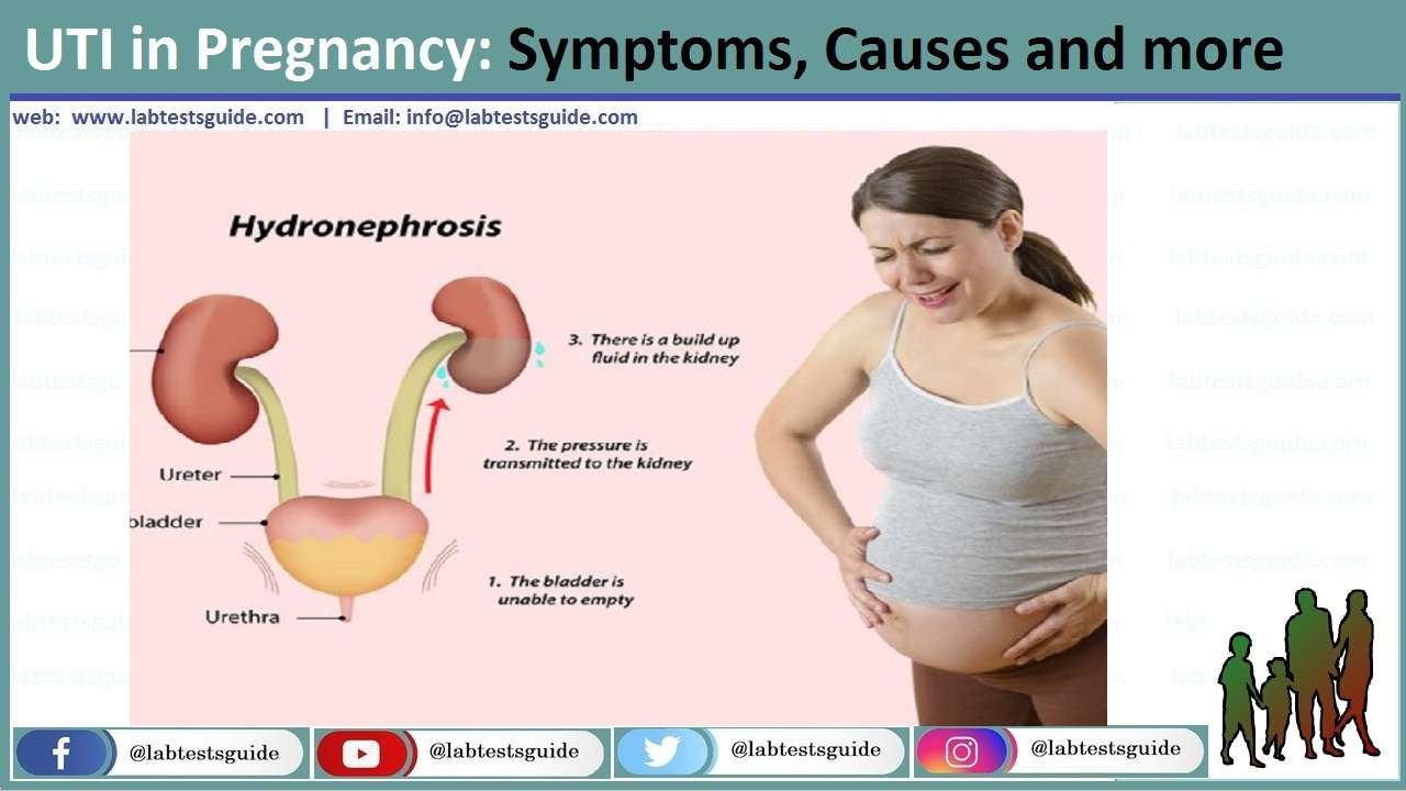 Urinary Tract Infection And Pregnancy / Antimicrobial ...