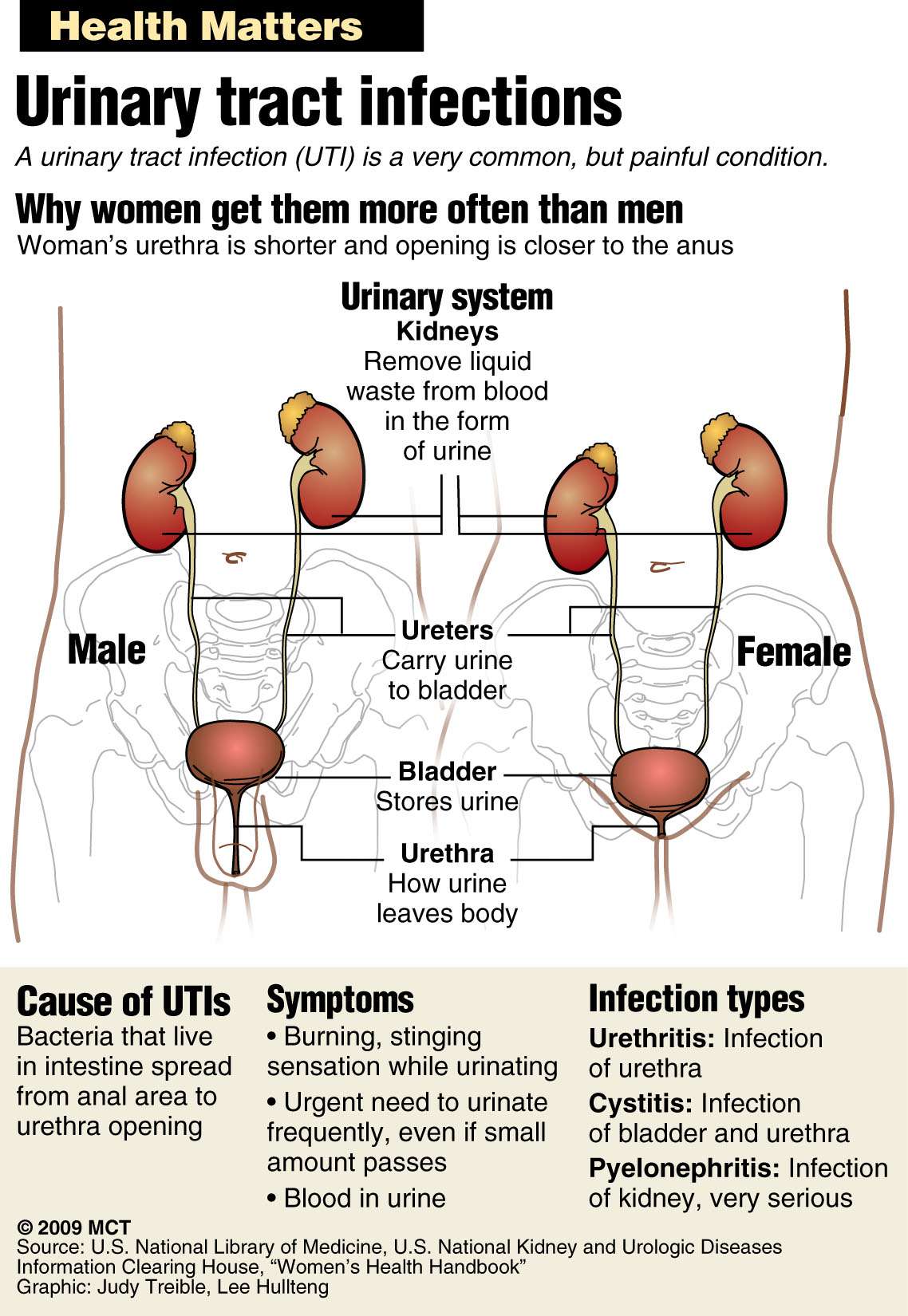 Urinary Tract Infection Tips Page 249