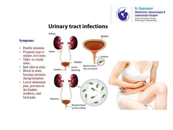 Urinary Tract Infection Treatment