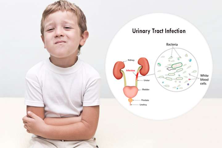 Urinary Tract Infection (UTI) In Children