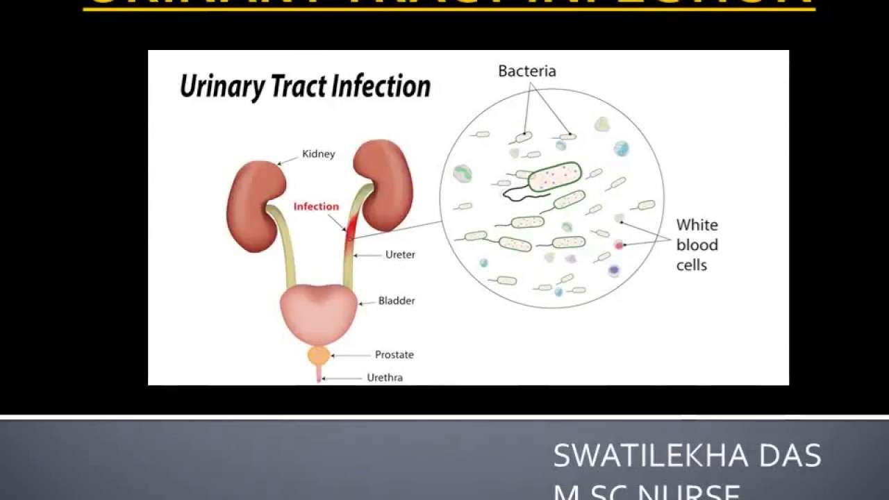 Urinary Tract Infection with Nursing Management