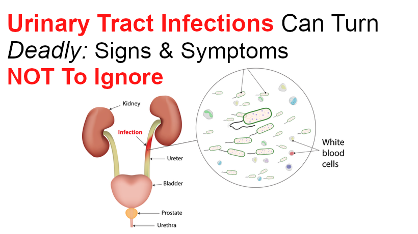 Urinary Tract Infections Can Turn Deadly: Signs and Symptoms Not To ...