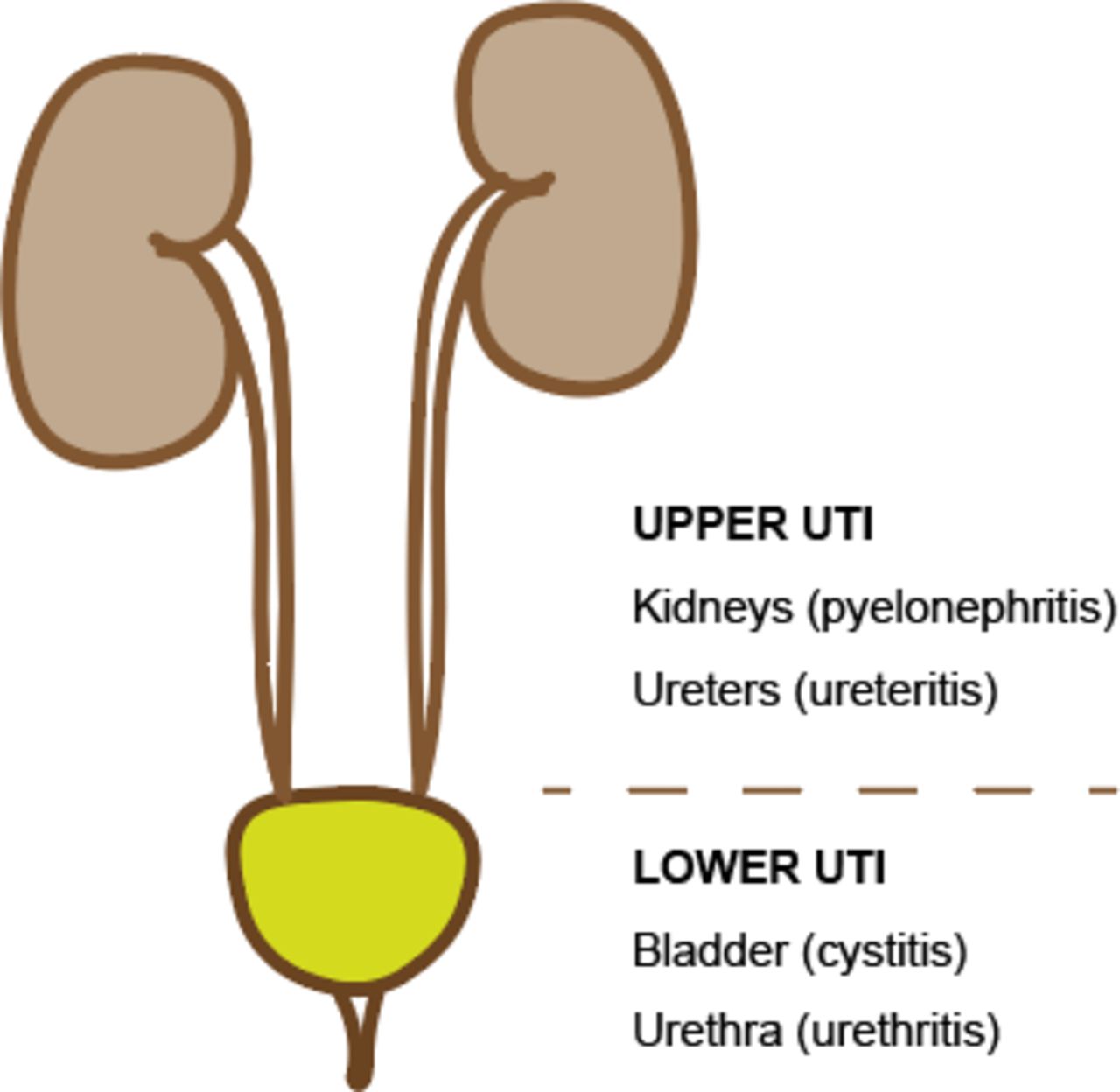 Urinary tract infections in children: an overview of diagnosis and ...