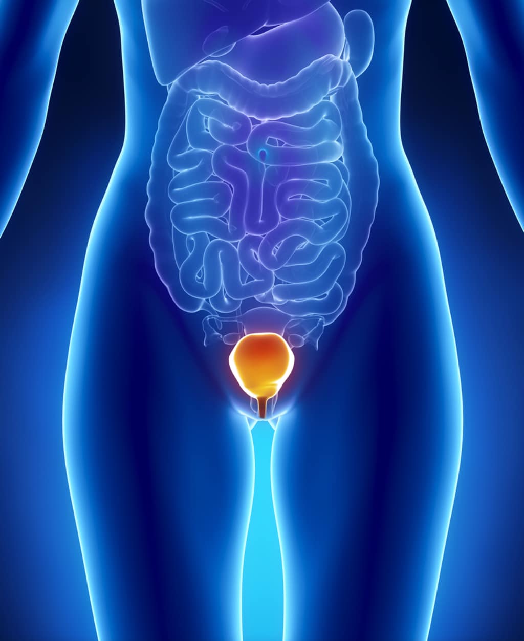 Urinary tract infections in women