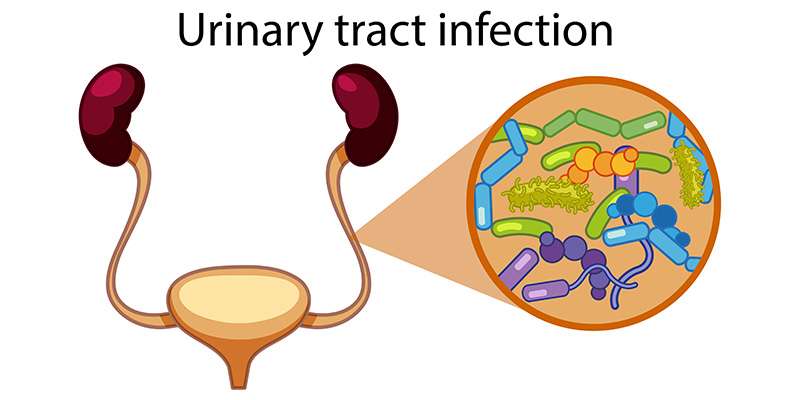 Urinary Tract Infections (UTI) â Symptoms, Types, Causes and Treatment