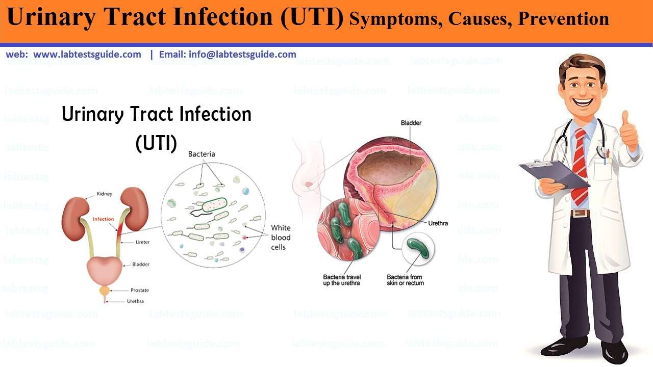 Urinary Tract Infections (UTI) Siigns &  Symptoms, Causes ...