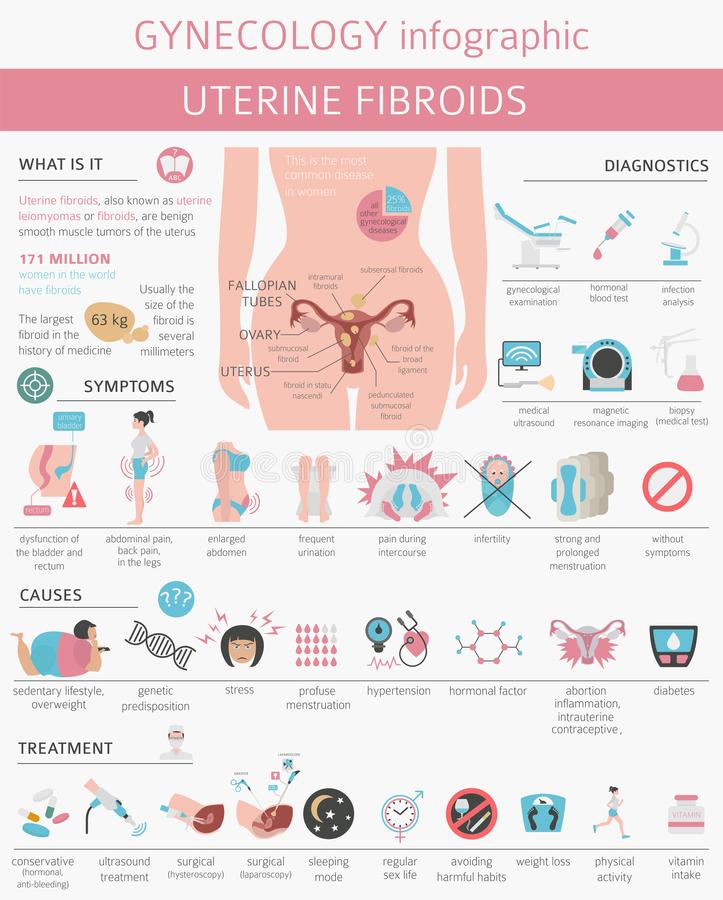 Uterine Fibroids. Ginecological Medical Desease in Women Infographic ...